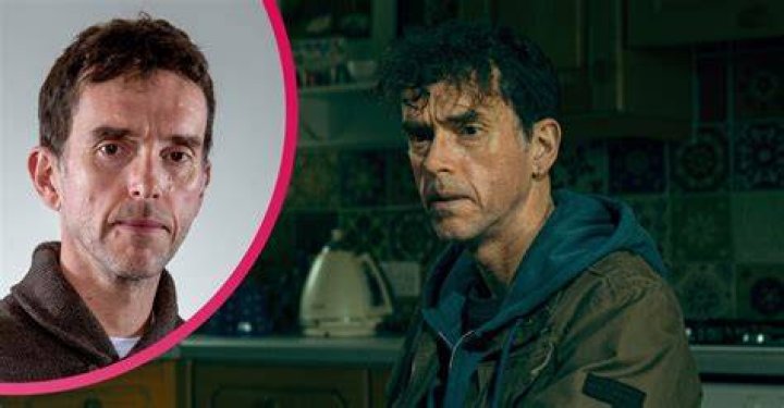 What Has Happened To Marlons Face In Emmerdale? Did Marlon Dingle Recover From Stroke?